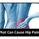 Causes of Hip Pain Gold coast Treatment