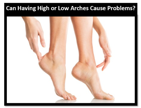 High Arch Pain or Low Arch Pain treatment Gold Coast